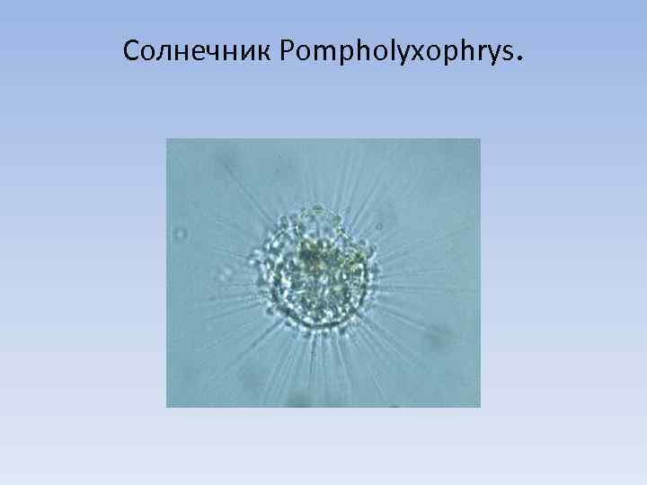 Солнечник Pompholyxophrys. 