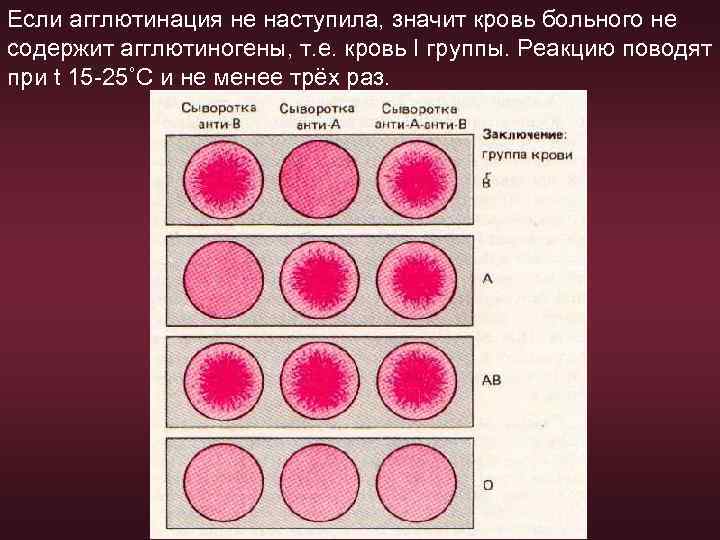 Гемопоэз схема кроветворения