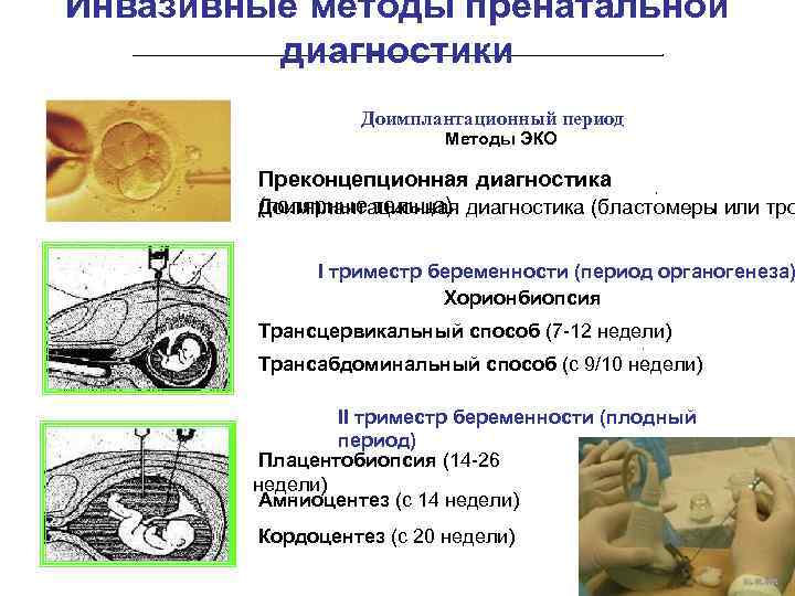 Инвазивные методы пренатальной диагностики Доимплантационный период Методы ЭКО Преконцепционная диагностика (полярные тельца) Доимплантационная диагностика
