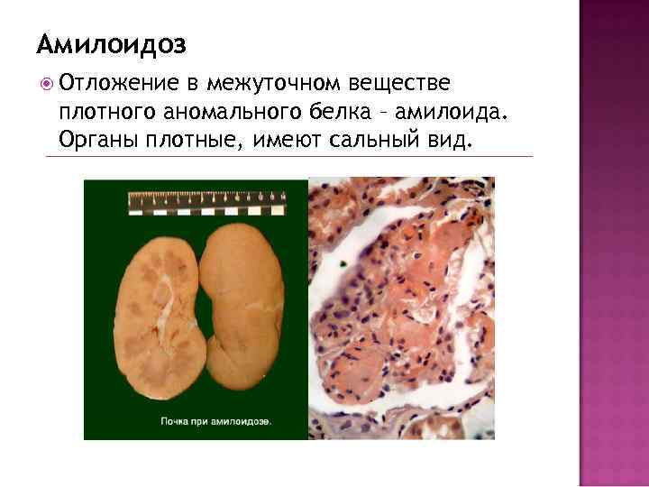 Аномальное влагалище фото