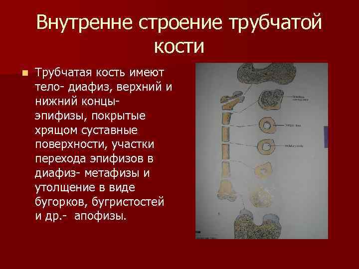 Внутренне строение трубчатой кости n Трубчатая кость имеют тело- диафиз, верхний и нижний концыэпифизы,