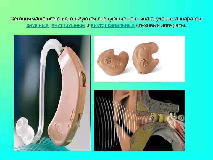 Сегодня чаще всего используются следующие три типа слуховых аппаратов: заушные, внутриушные и внутриканальные слуховые
