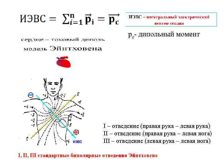 pc- дипольный момент I – отведение (правая рука – левая рука) II – отведение