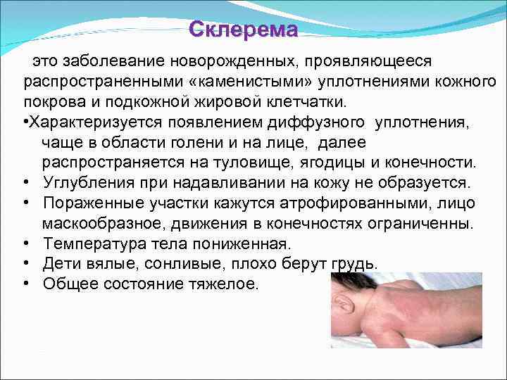 Неинфекционные заболевания кожи новорожденных презентация