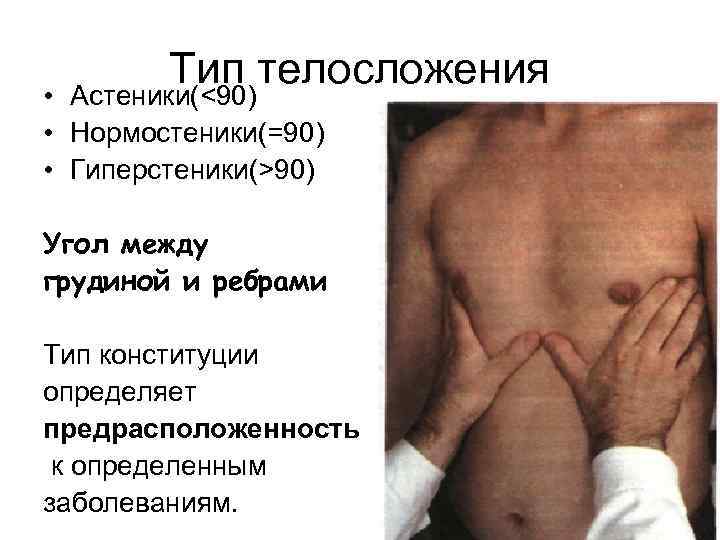 Тип телосложения • Астеники(<90) • Нормостеники(=90) • Гиперстеники(>90) Угол между грудиной и ребрами Тип