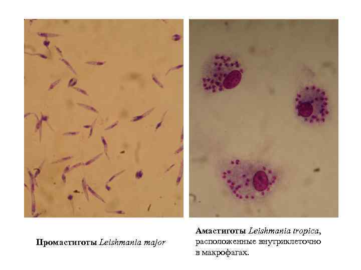 Промастиготы Leishmania major Амастиготы Leishmania tropica, расположенные внутриклеточно в макрофагах. 