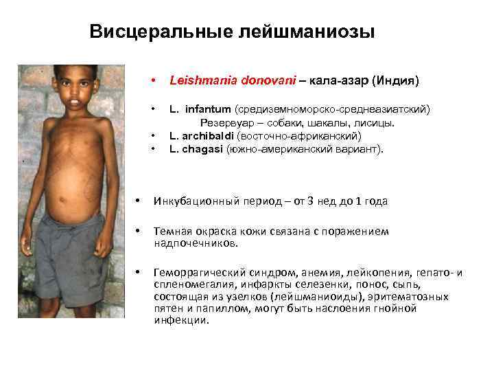 Висцеральные лейшманиозы • Leishmania donovani – кала-азар (Индия) • L. infantum (средиземноморско-среднеазиатский) Резервуар –