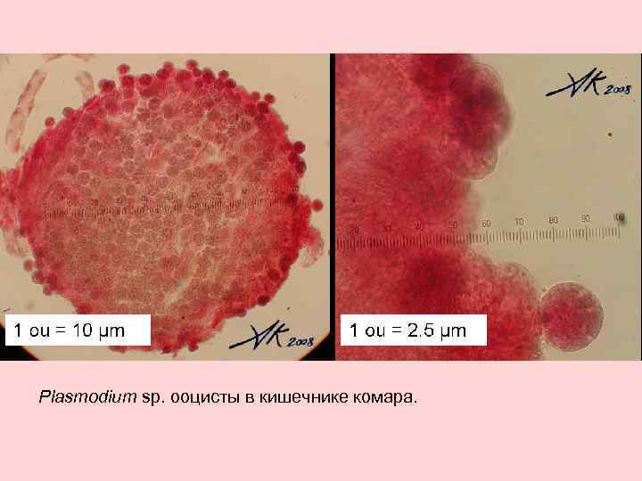 Plasmodium sp. ооцисты в кишечнике комара. 