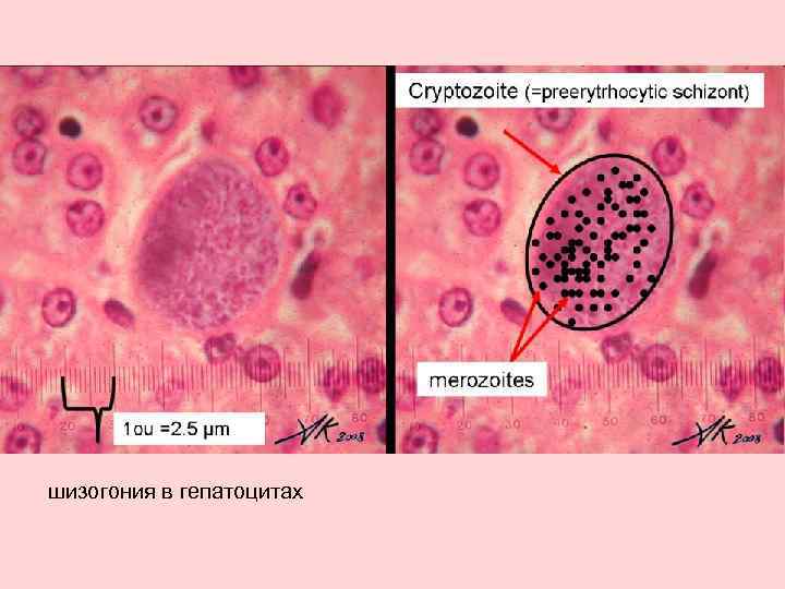шизогония в гепатоцитах 