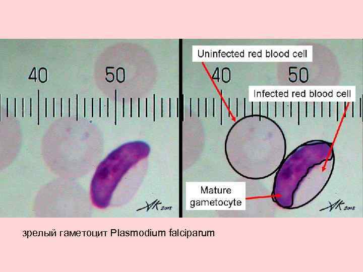 зрелый гаметоцит Plasmodium falciparum 