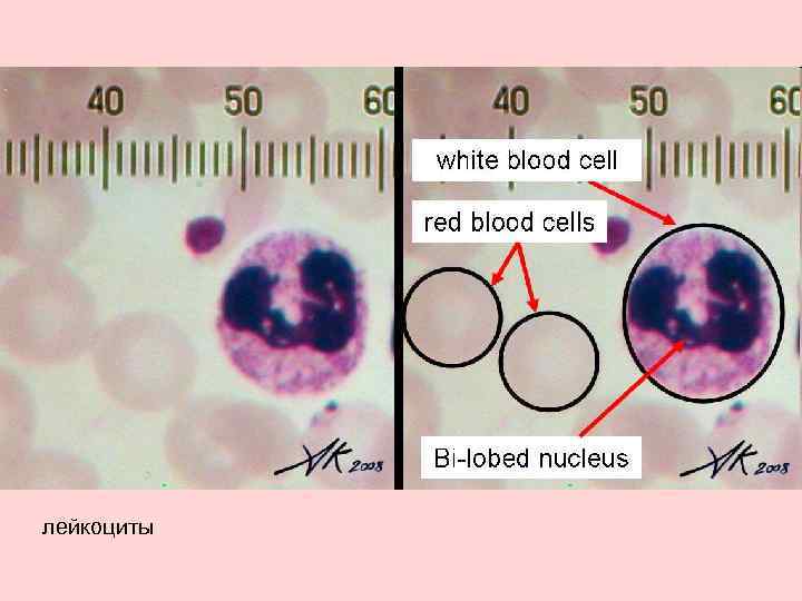 лейкоциты 