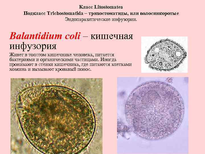 Класс Litostomatea Подкласс Trichostomatida – трихостоматиды, или волосинкоротые Эндопаразитические инфузории. Balantidium coli – кишечная