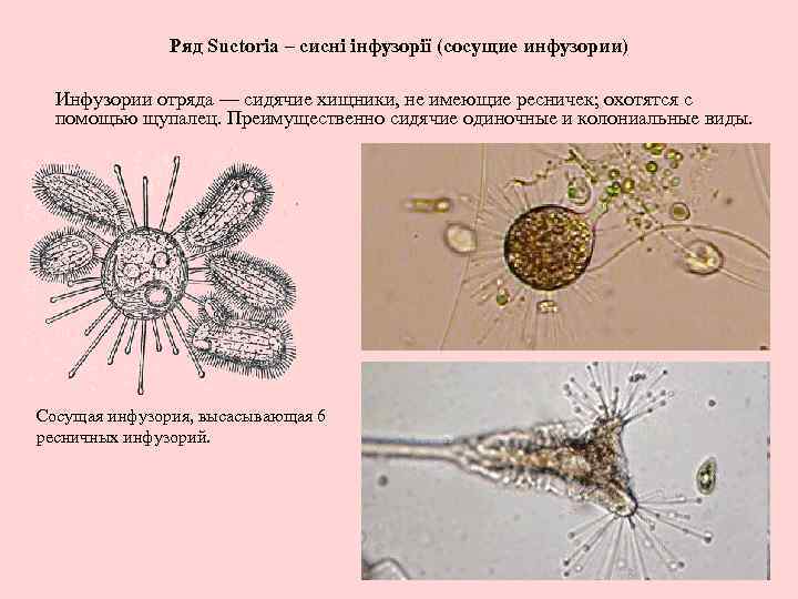 Ряд Suctoria – сисні інфузорії (сосущие инфузории) Инфузории отряда — сидячие хищники, не имеющие