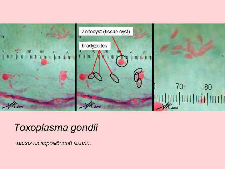 Toxoplasma gondii мазок из заражённой мыши. 