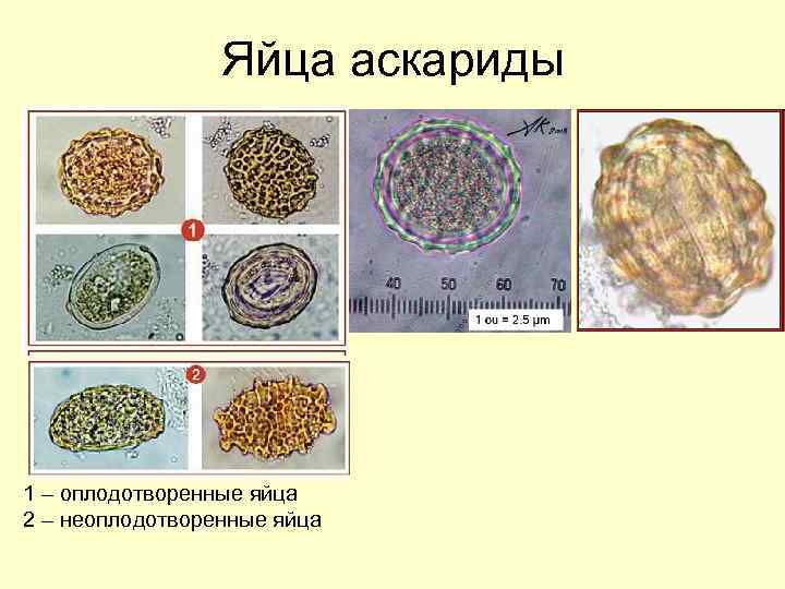 Яйца аскариды 1 – оплодотворенные яйца 2 – неоплодотворенные яйца 