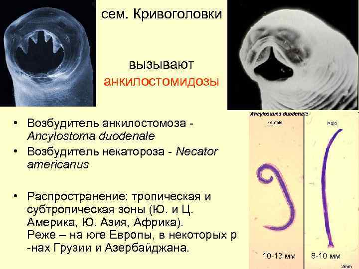 сем. Кривоголовки вызывают анкилостомидозы • Возбудитель анкилостомоза Ancylostoma duodenale • Возбудитель некатороза - Necator