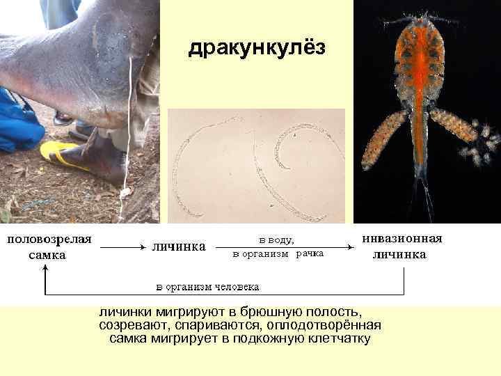 дракункулёз личинки мигрируют в брюшную полость, созревают, спариваются, оплодотворённая самка мигрирует в подкожную клетчатку