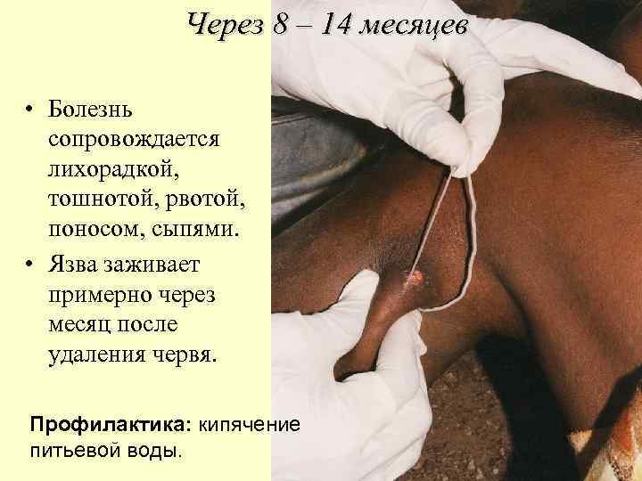 Через 8 – 14 месяцев • Болезнь сопровождается лихорадкой, тошнотой, рвотой, поносом, сыпями. •