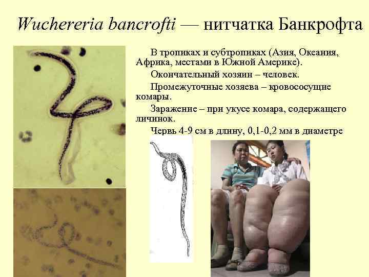 Wuchereria bancrofti — нитчатка Банкрофта В тропиках и субтропиках (Азия, Океания, Африка, местами в