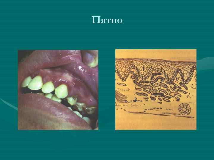 Пятно 