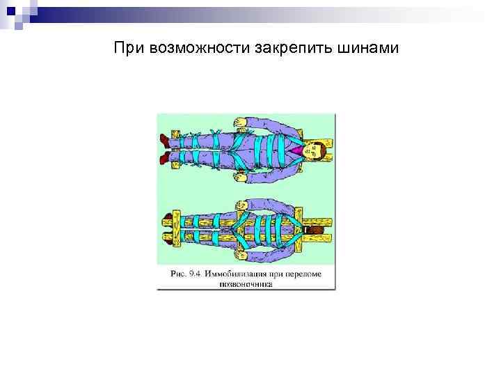 При возможности закрепить шинами 