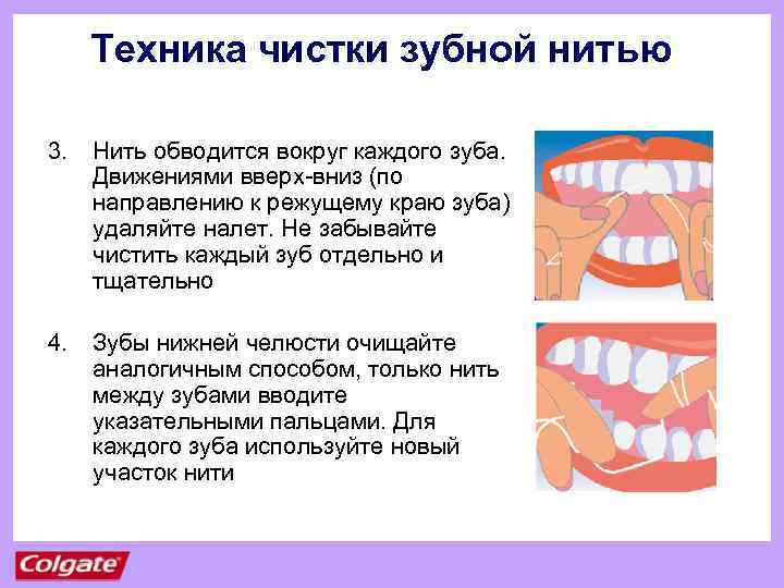 Техника чистки зубной нитью 3. Нить обводится вокруг каждого зуба. Движениями вверх-вниз (по направлению