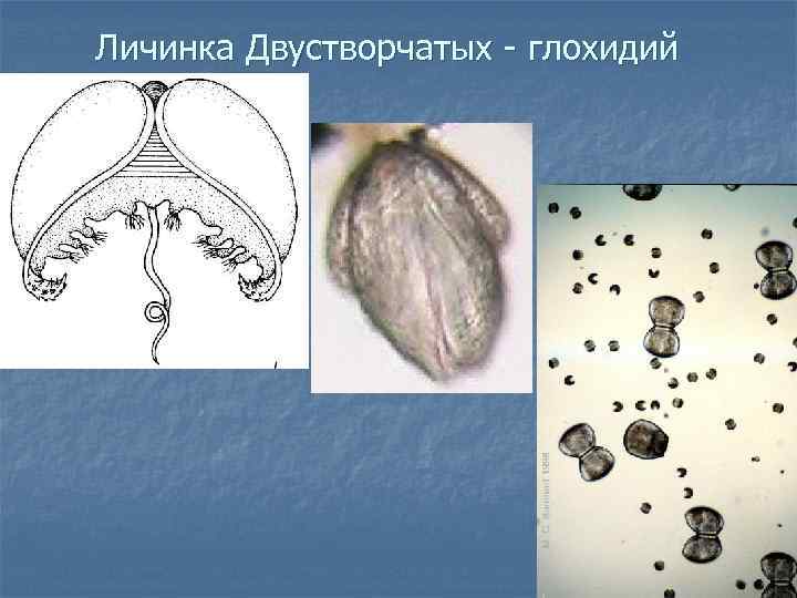 Личинки моллюсков. Глохидий беззубки. Строение личинки глохидии. Глохидии личинки беззубки. Жизненный цикл глохидии.