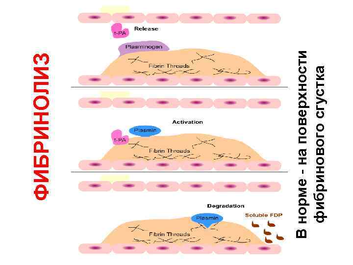 В норме - на поверхности фибринового сгустка ФИБРИНОЛИЗ 