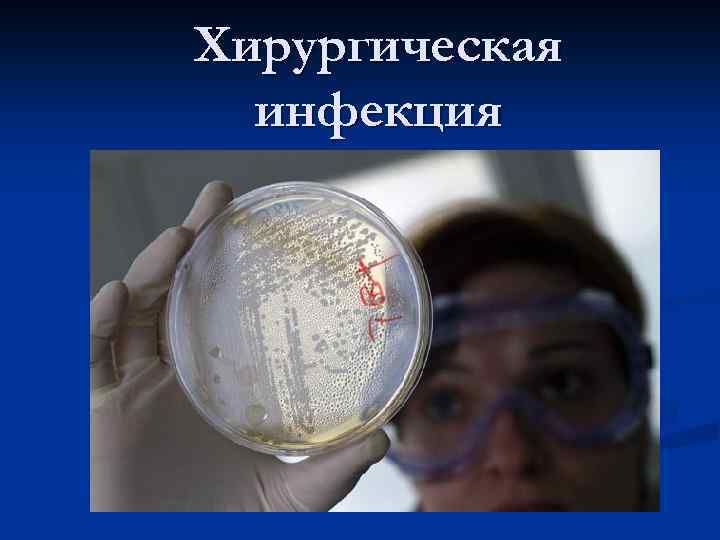 Хирургическая инфекция 