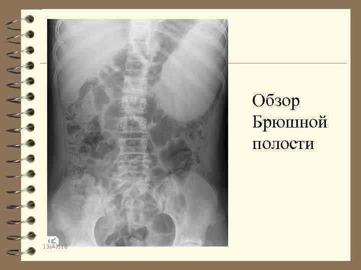 Обзор Брюшной полости 13: 41: 16 