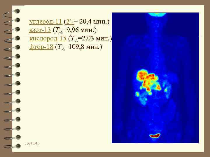 углерод-11 (T½= 20, 4 мин. ) азот-13 (T½=9, 96 мин. ) кислород-15 (T½=2, 03