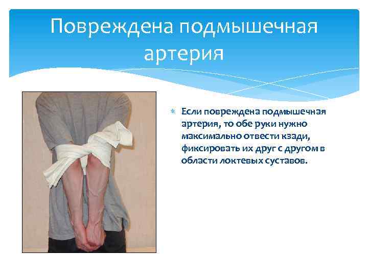 Повреждена подмышечная артерия Если повреждена подмышечная артерия, то обе руки нужно максимально отвести кзади,