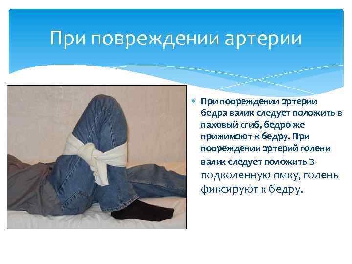 При повреждении артерии бедра валик следует положить в паховый сгиб, бедро же прижимают к