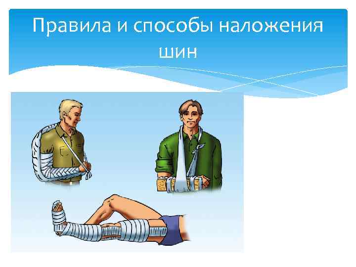 Правила и способы наложения шин 