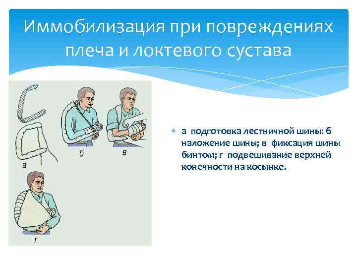 Иммобилизация при повреждениях плеча и локтевого сустава а подготовка лестничной шины: б наложение шины;