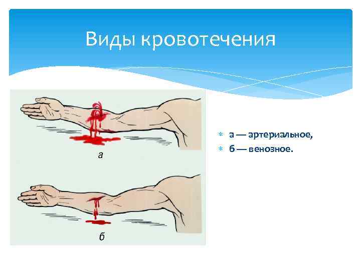 Картинка точки прижатия артерий