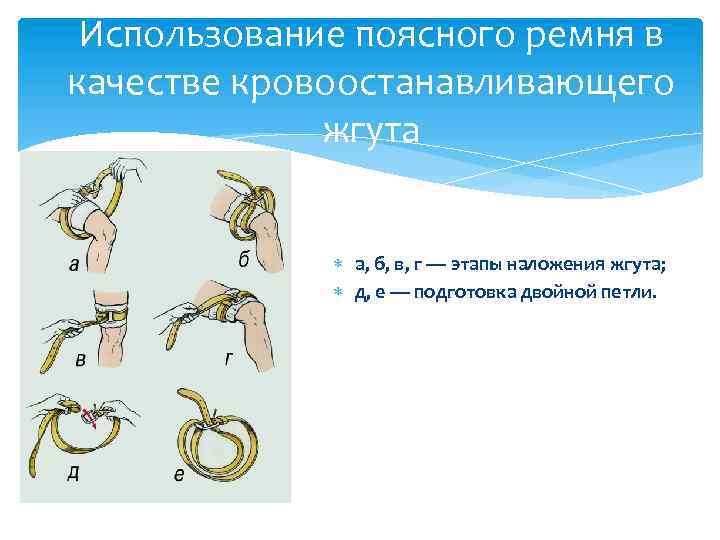 Использование поясного ремня в качестве кровоостанавливающего жгута а, б, в, г — этапы наложения