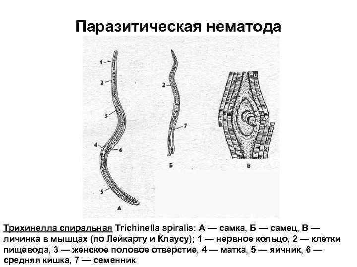 Паразитическая нематода Трихинелла спиральная Trichinella spiralis: А — самка, Б — самец, В —
