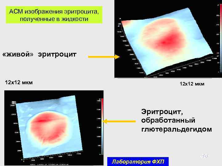 АСМ изображения эритроцита, полученные в жидкости «живой» эритроцит 12 х12 мкм Эритроцит, обработанный глютеральдегидом