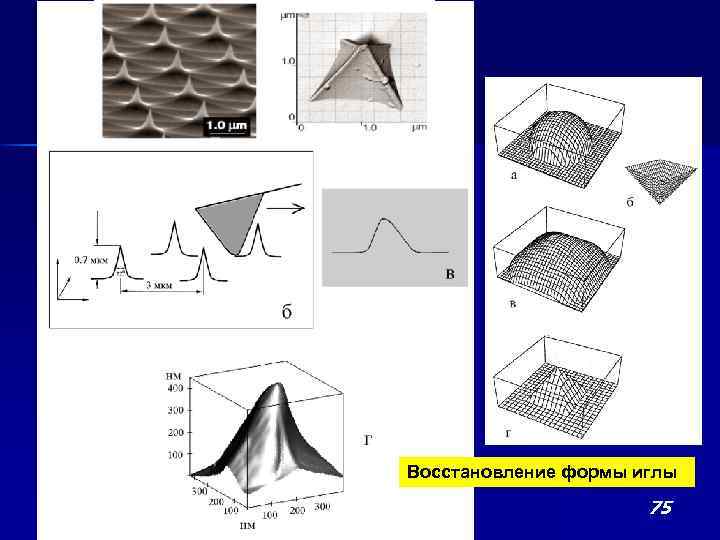 Восстановление формы иглы 75 