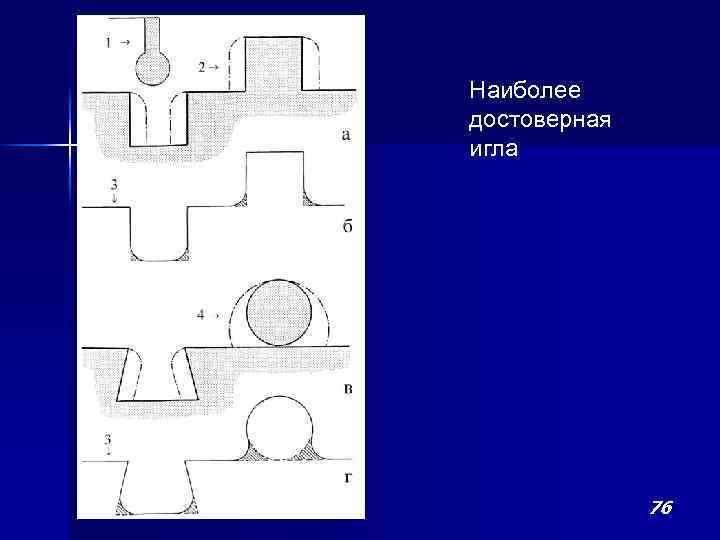 Наиболее достоверная игла 76 