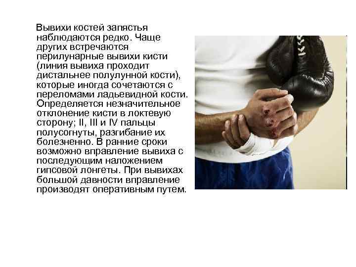 Вывихи костей запястья наблюдаются редко. Чаще других встречаются перилунарные вывихи кисти (линия вывиха проходит