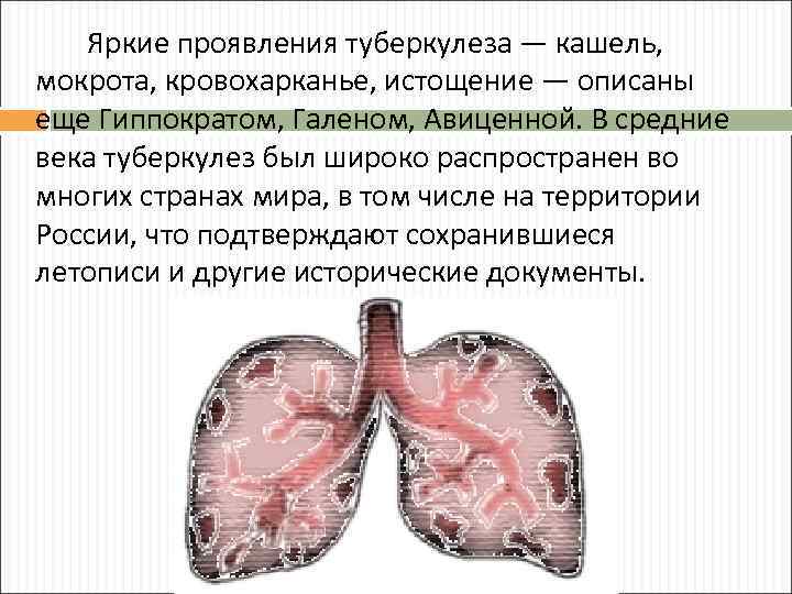 Яркие проявления туберкулеза — кашель, мокрота, кровохарканье, истощение — описаны еще Гиппократом, Галеном, Авиценной.