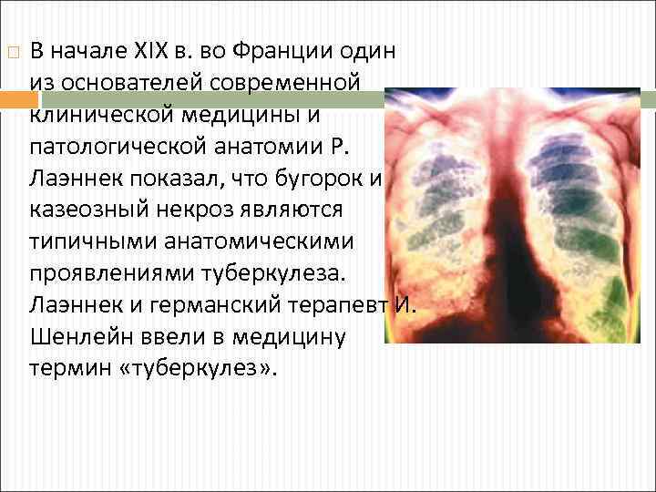  В начале XIX в. во Франции один из основателей современной клинической медицины и