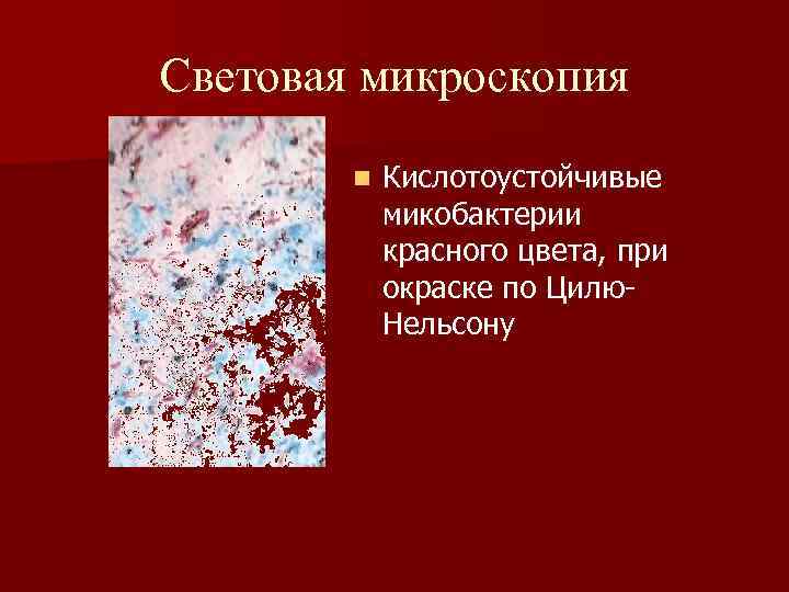 Микобактерии методы микроскопии