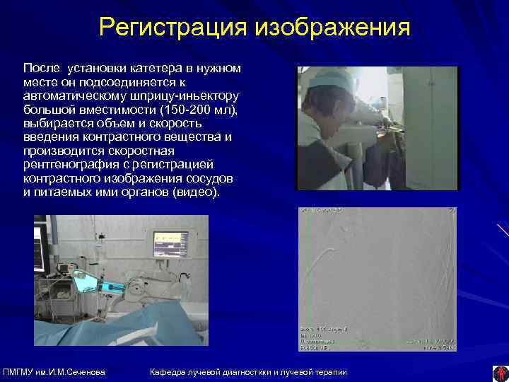 Регистрация изображения После установки катетера в нужном месте он подсоединяется к автоматическому шприцу-иньектору большой