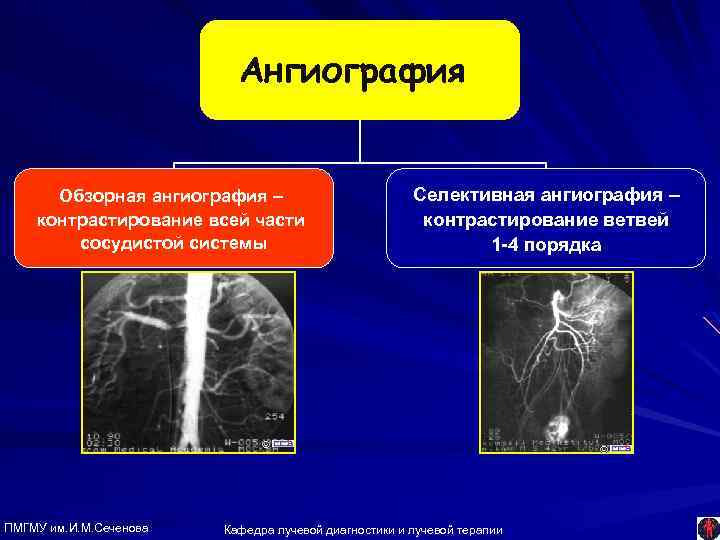 Ангиография Обзорная ангиография – контрастирование всей части сосудистой системы ПМГМУ им. И. М. Сеченова