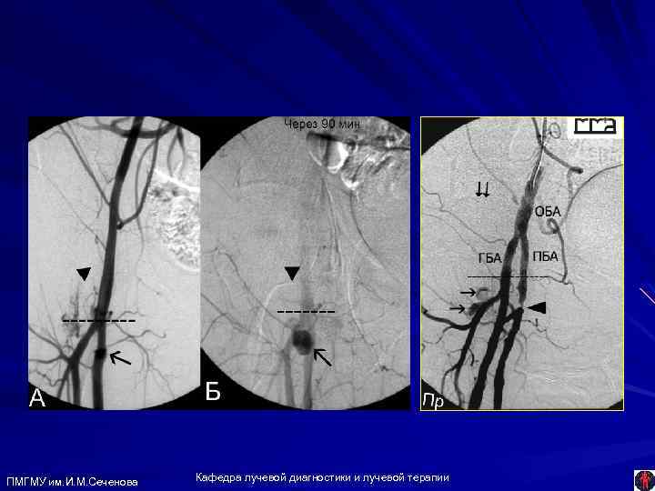 ПМГМУ им. И. М. Сеченова Кафедра лучевой диагностики и лучевой терапии 
