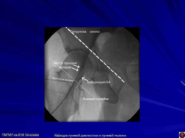 ПМГМУ им. И. М. Сеченова Кафедра лучевой диагностики и лучевой терапии 