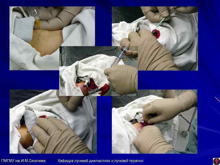 ПМГМУ им. И. М. Сеченова Кафедра лучевой диагностики и лучевой терапии 